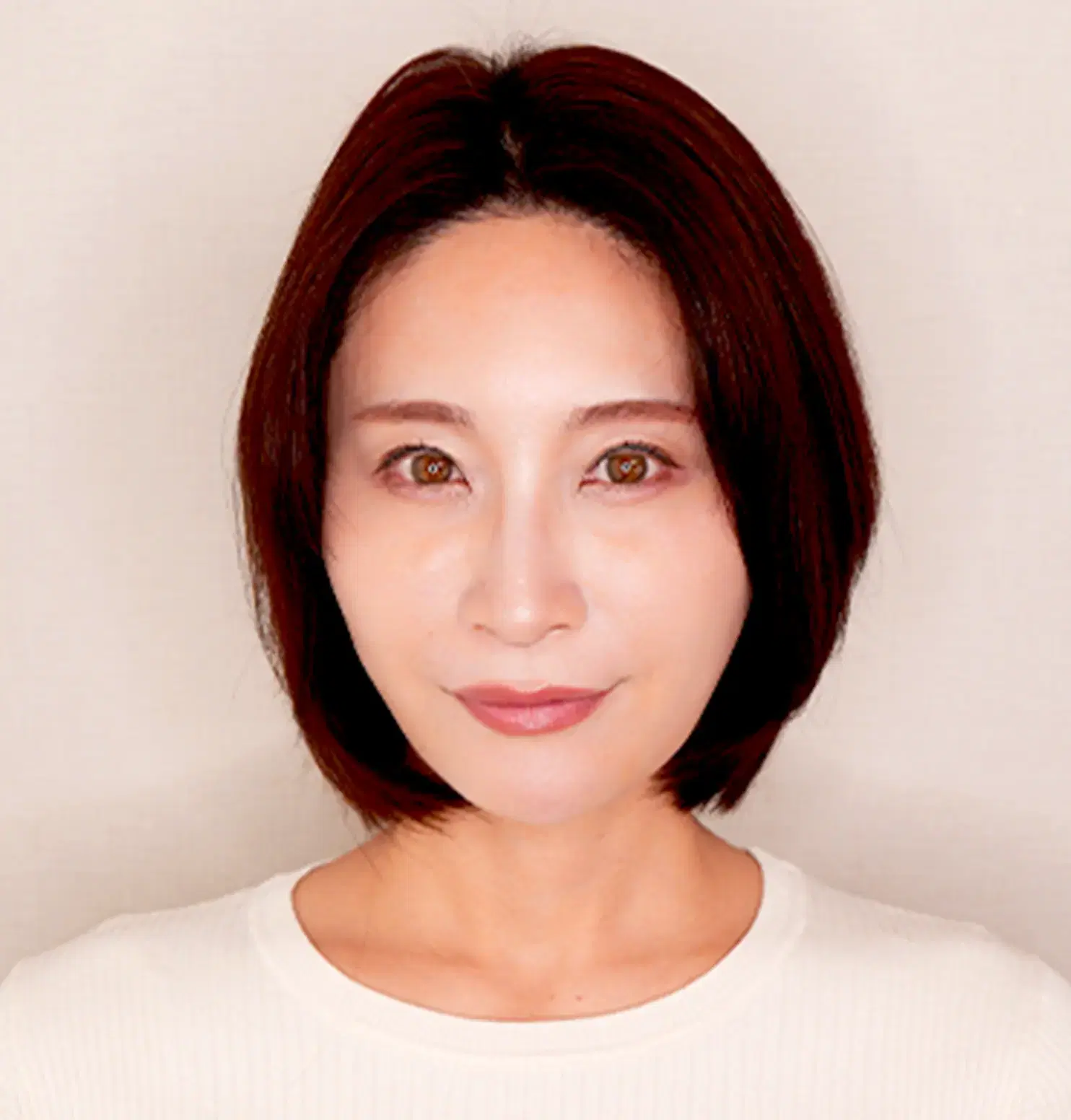 Mさん（女性/42歳） After