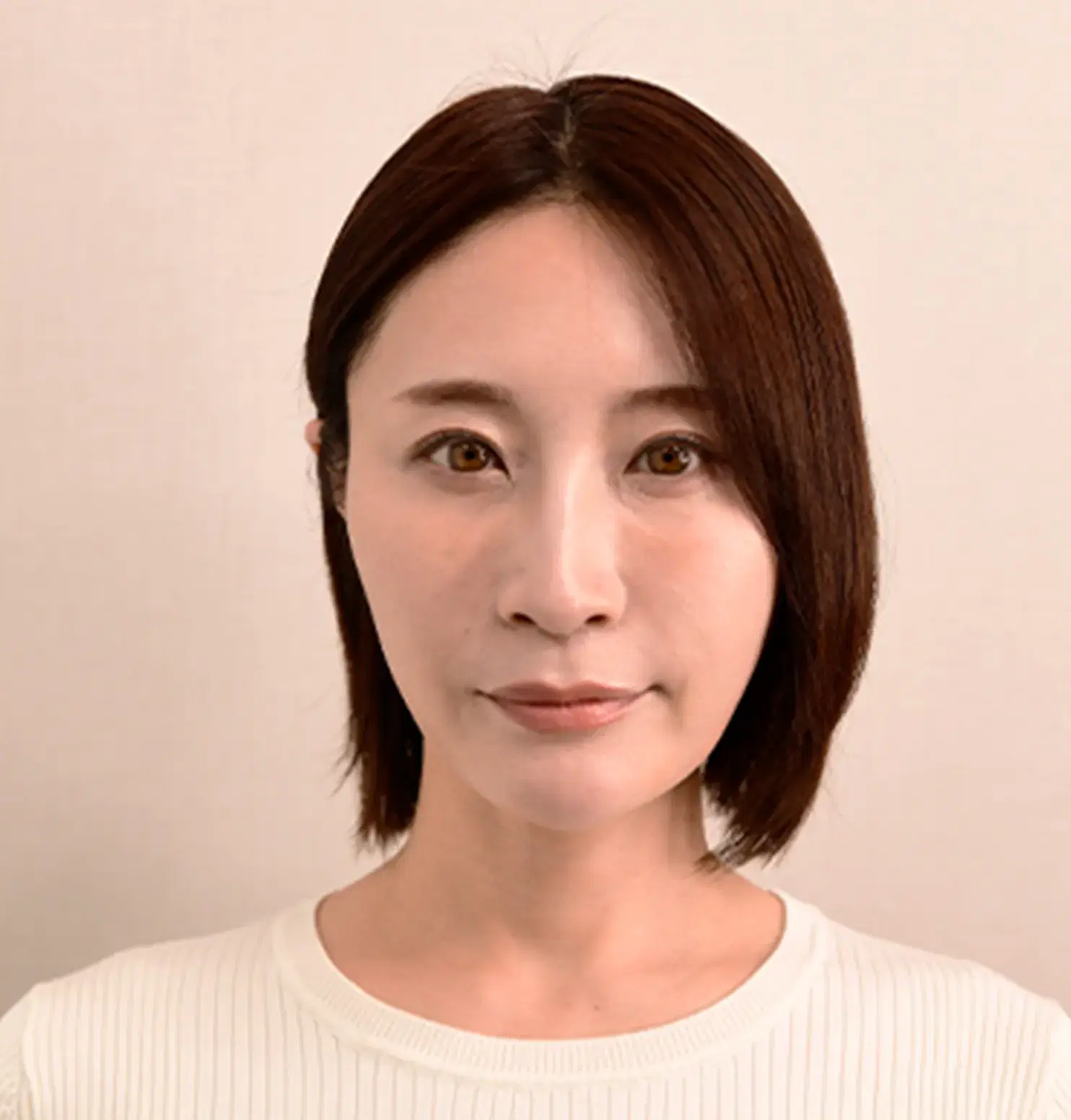 Mさん（女性/42歳） Before