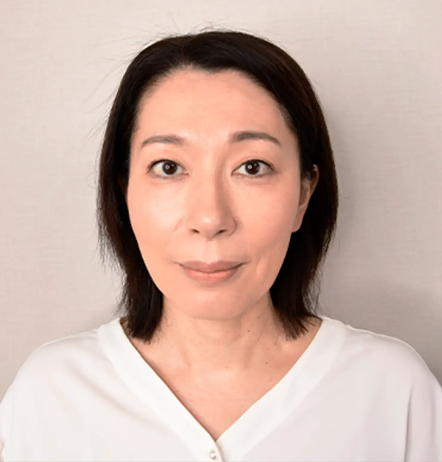 ゆきさん（女性/51歳） Before